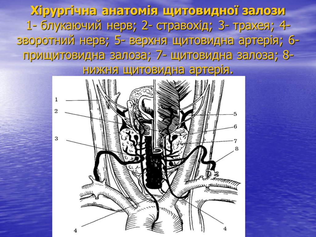 Хірургічна анатомія щитовидної залози 1- блукаючий нерв; 2- стравохід; 3- трахея; 4- зворотний нерв;